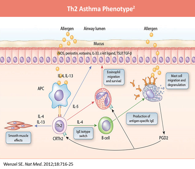 BREATH_Th2-Asthma-Phenotype